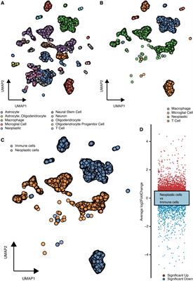 Machine learning-based discovery of UPP1 as a key oncogene in tumorigenesis and immune escape in gliomas